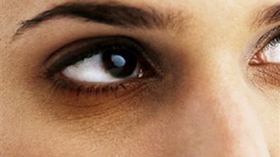 دراسة تحذر من الهالات السوداء تحت العين