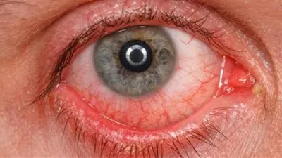 أكتشف أسباب علاج 