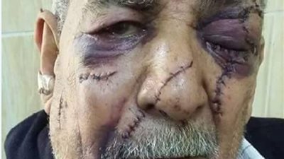 ابن شقيقة المسن الذي تعرض لـ35 طعنة لسرقة معاشه: 
