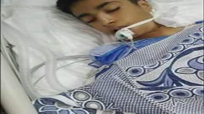 طفل دخل لإجراء عملية 