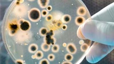 أهم أخبار الاردن اليوم .. نسب الجراثيم بالأردن تفوق مثيلاتها بالمنطقة