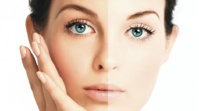 3 كريمات طبيعية منزلية لتبييض الوجه