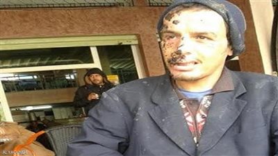 مرض غريب.. مغربي يرتفع إلى السماء ثم يسقط أرضا