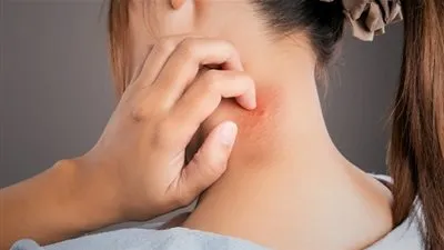 8 أسباب شائعة وراء النتوءات الحمراء والحكة الجلدية