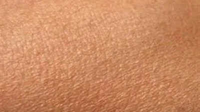 10 أخطاء شائعة نرتكبها تصيب بالأمراض الجلدية