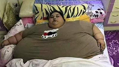 هذا ما حصل لأسمن امرأة مصرية بعد وقت قصير من دخولها المستشفى !