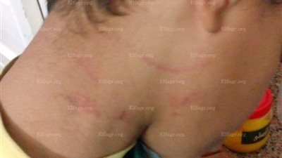 معلمة بالسويس تعتدي على طالب بالضرب: 