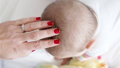 أسباب وطرق علاج قشور فروة الرأس عند حديثى الولادة