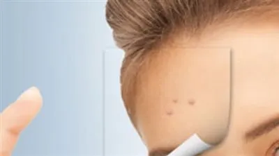 لإزالة الرؤوس السوداء بدقائق قليلة..إليكم هذه الخدعة المعجزة ! 