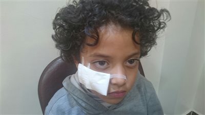 ولى أمر طالب أُصيب بعاهة مستديمة يحرر محضرًا ضد مدرسة خاصة بالسويس