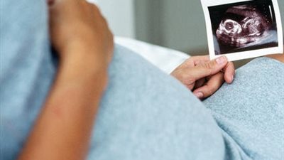 الوقت المثالي لإجراء أشعة الـ4D على الجنين