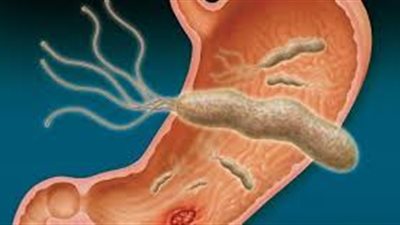 اكتشاف سر خطير عن بكتيريا المعدة.. تعرف عليه