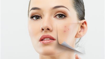 جربي هذه الزيوت الطبيعية للتخلص من حبوب البشرة