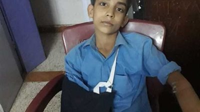 ولي أمر يتهم مدرسًا بـ«كسر ذراع» نجله في المنيا