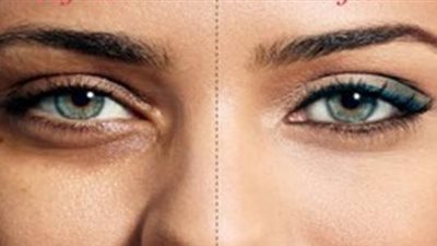 وصفة مجربة للتخلص من الهالات السوداء تحت العين