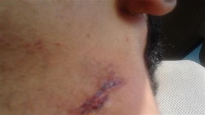 صاحب كشك يصيب مندوب مبيعات ويستولي على سيارته بالفيوم