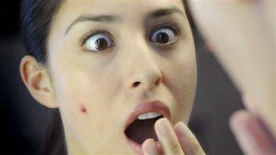 10 أسباب غير متوقعة لظهور الحبوب.. اكتشفيها!