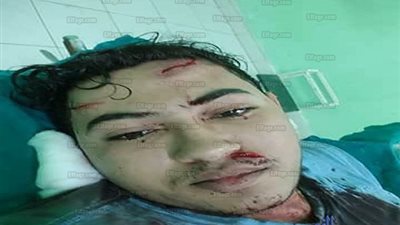 السجن 5 سنوات للمتهمين باستدراج طالب وتشويه وجهه عبر موقع 