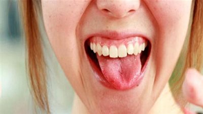 إليكِ أسباب وأعراض مشكلة 