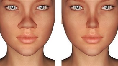 بدون عمليات تجميل.. خطوات للحصول على أنف مثالي