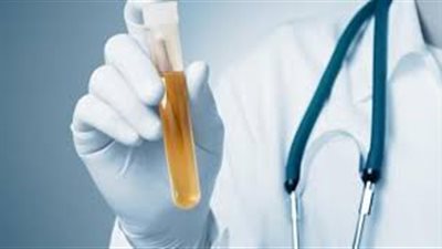 قائمة بألوان البول المختلفة تعكس صحة جسمك 