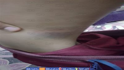 ولي أمر يحرر محضرًا ضد معلم اعتدى على نجله بمدرسة إبتدائية بأسيوط (صورة)