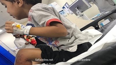 صدي - السعودية| كائن بحري يصيب طفل في شاطئ المرجان بجازان