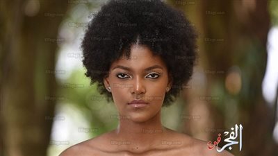 أول تعليق من ملكة جمال إفريقيا بعد احتراقها في حفل تتويجها باللقب