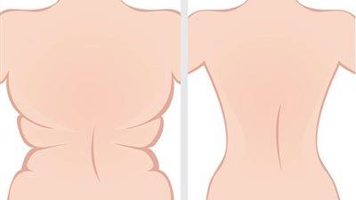 تمارين بسيطة لشد الترهلات والتخلص من دهون الظهر (فيديو) 