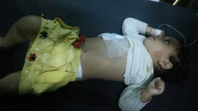 مقتل طفل وإصابة3 آخرين بصواريخ الكاتيوشا الحوثية