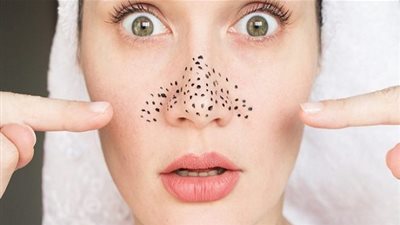 بهذه الطريقة تخلصي من مشكلة الرؤوس السوداء على أنفك نهائيا (فيديو)