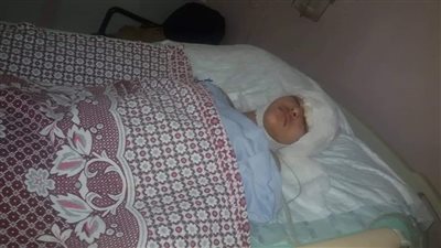 محافظ الإسماعيلية يتابع مع رئيس أركان الجيش حالة الطفلة 