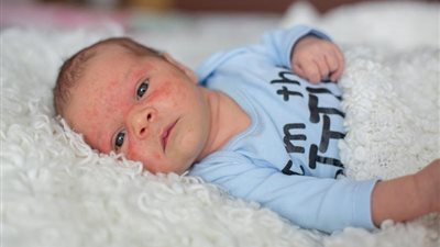 طريقة لحماية بشرة مولودك من برودة الشتاء
