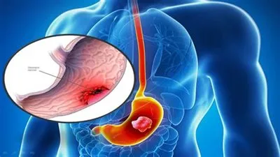 تفاصيل استخراج 