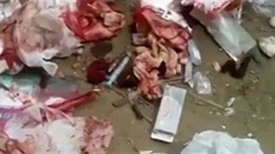 كارثة.. نفايات طبية وبواقي أجزاء بشرية ملقاة أمام حضانة بحلوان (صور)