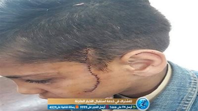 تلميذ ابتدائي يقطع وجه زميله بـ