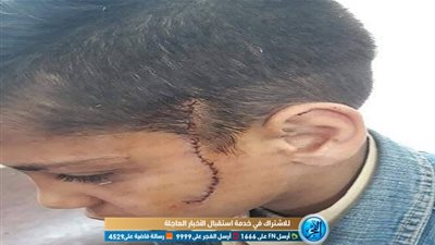 القبض على التلميذ المتهم بتمزيق وجه زميله بسلاح أبيض في المرج (صور)