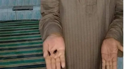 بعد اجتياحها عدة محافظات.. ظهور الخنفساء السوداء في الأقصر (صور) 