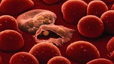 في اليوم العالمي.. أسباب وأعرض مرض الإيدز