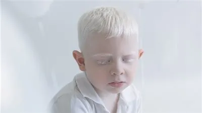 في يومه العالمي.. ما هي التحديات الصحية التي تواجه المصابون بـ