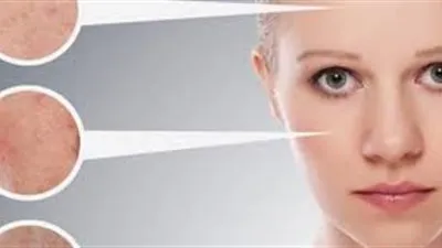 طريقة بسيطة لترطيب البشرة الجافة (فيديو)