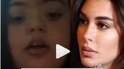 شاهد.. رسالة نارية من مصابة متلازمة داون لياسمين صبري (فيديو)