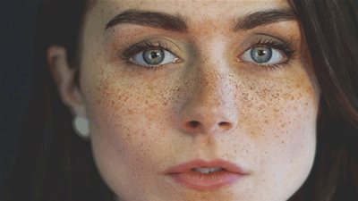 خلطات طبيعية للقضاء على بقع النمش المزعجة.. جربيها