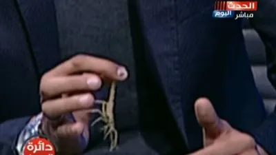 شاهد.. ضيف يخرج عقرب ويلدغ نفسه على الهواء (فيديو)