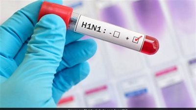 عدد الوفيات الناجمة عن إنفلونزا الخنازير يقترب من 100 في ميانمار