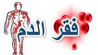 فقر الدم.. تعرف على أسبابه وعلاجه