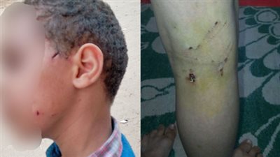 عقر 7 أطفال وحملات وهمية.. تفاصيل قصة 