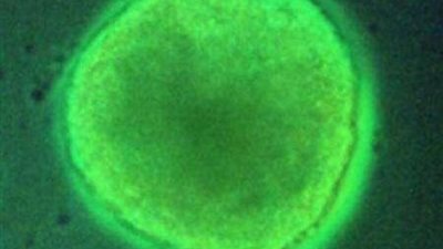 ماذا يحدث للذاكرة أثناء النوم؟