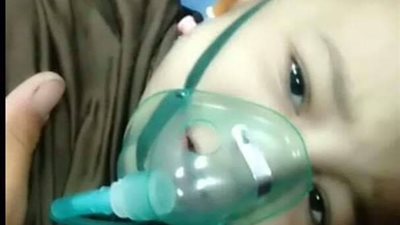 بعد بتر ساقها| عاجل.. وفاة الطفلة 