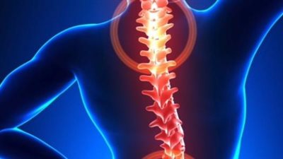 في يومها العالمي.. أطعمة صحية للقضاء على هشاشة العظام نهائيا